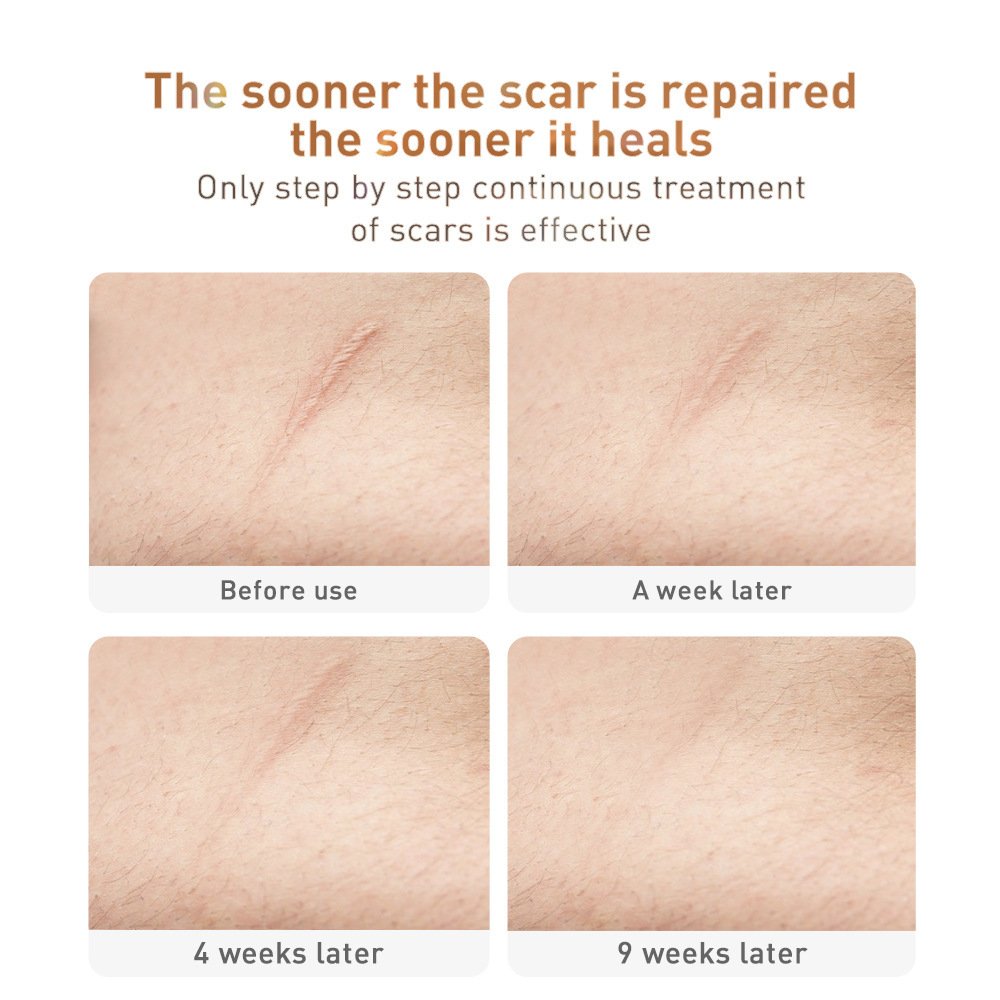 Traditional Chinese Medicine Scar Removal Cream Care Cream Skin Care Products - Image 3