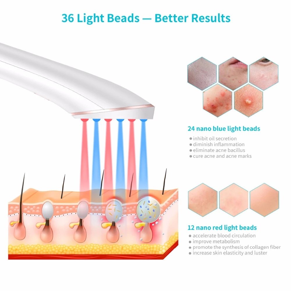Acne Light Therapy Xpreen Wireless Rechargeable Light Acne Treatment Device Acne Clearing Eraser with Blue Light and Red Light - Image 8